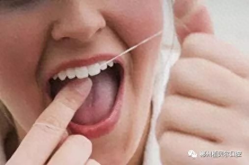 牙线是清洁牙缝、牙齿邻接面和食物嵌塞最健康有效的工具，但有很多人还不会使用，或使用不当，反而造成牙龈损伤、牙齿松动等不良后果。因此我们来学习一下牙线的正确使用方法